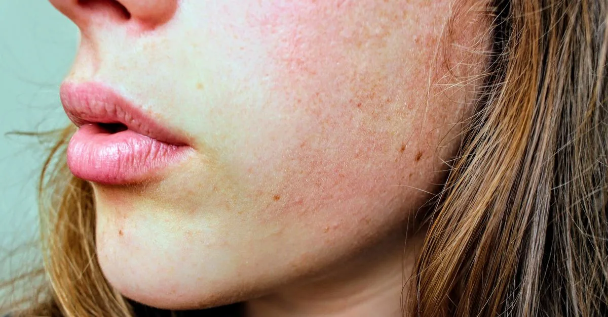 découvrez une routine de soins adaptée aux peaux mixtes avec imperfections pour un teint purifié, équilibré et éclatant au quotidien.